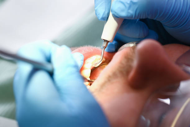 Best Mobile Emergency Dentist in Bazon, CA