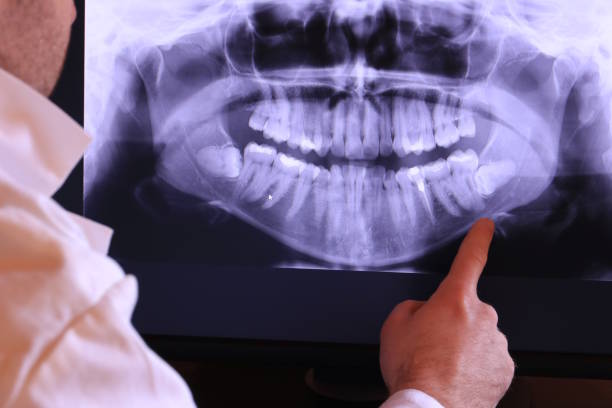 Best Emergency Dentist for Special Needs Patients in Bazon, CA