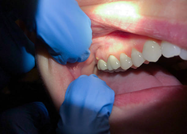 Best Emergency Dental Services for Seniors in Bazon, CA